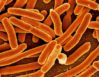 Image: Colored scanning electron micrograph (SEM) of Escherichia coli bacteria (Photo courtesy of NIAID / CDC).
